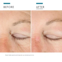 A.G.E. Advanced Eye, 15 ml. - Skinceuticals