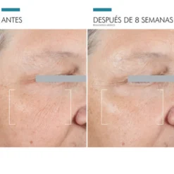 A.G.E. Advanced Eye, 15 ml. - Skinceuticals