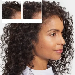 Champú Anticaída - Champú para la Caída del Cabello 475 ml - Nioxin