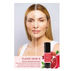 Clear Skin R Gel-Crema Despigmentante y Luminosidad, 30 ml. - Segle Clinical