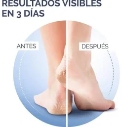 Crema Talones Agrietados K+ (1 Envase 60 ml) - Reckitt Benckiser
