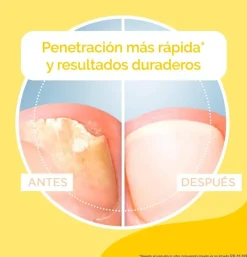 Dr Scholl Antihongos Tratamiento Uñas (1 Envase 3,8 ml + 5 Limas) - Reckitt Benckiser