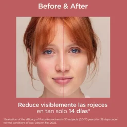 Fotoultra Redness SPF 50, 50 ml. - Isdin