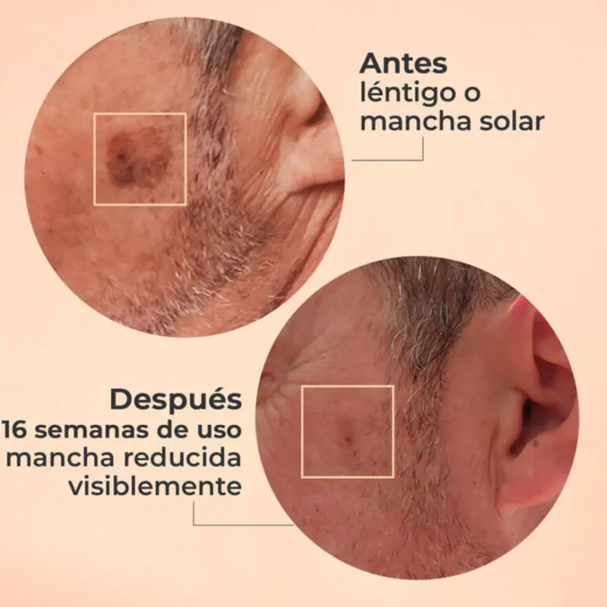 Glicolmix Sérum Exfoliante Facial, 30 ml. - Segle Clinical