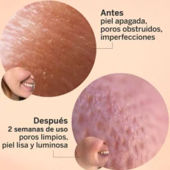 Glicolmix Sérum Exfoliante Facial, 30 ml. - Segle Clinical