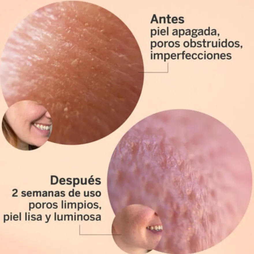 Glicolmix Sérum Exfoliante Facial, 30 ml. - Segle Clinical