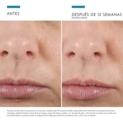 H.A Intensifier, 30 ml. - Skinceuticals
