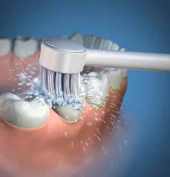 Irrigador Bucal Electrico Recambio - Waterpik Wp- 100 /Wp 450 (Boquilla Cepillo De Dientes)