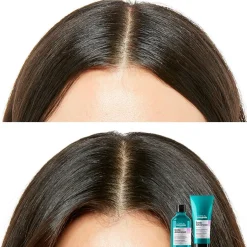 L'oréal Scalp Advanced Anti - Discomfort Dermo - Regulator Shampoo 300ml - L'oral