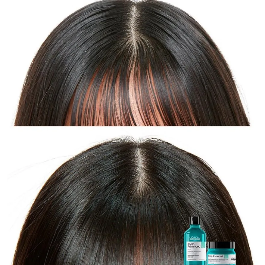 L'oréal Scalp Advanced Anti - Oiliness 2in1 Deep Purifier Clay 250ml - L'oral