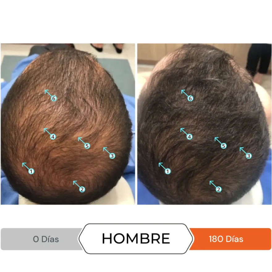 Revita® Anticaída, 30 Comp. - DS Laboratories