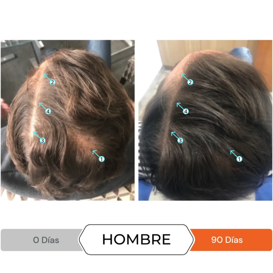 Revita® Champú Estimulante, 205 ml. - DS Laboratories
