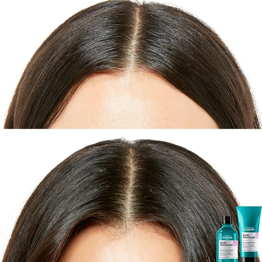 Scalp Advanced Champú Recarga 500 ml - Loral Professionnel Paris