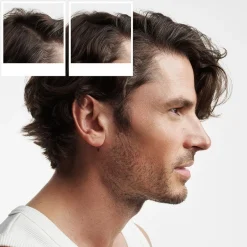 Sistema 2 - Kit - Tratamiento para Cabello Natural con Debilitamiento Avanzado 3 u - Nioxin