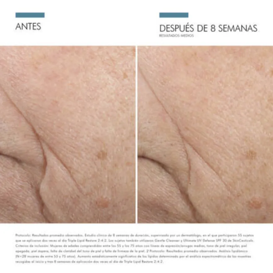 Triple Lipid Restore 2:4:2, 48 ml. - Skinceuticals