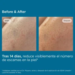 Ureadin Lotion10 Hidratación Intensa, 200 ml. - Isdin